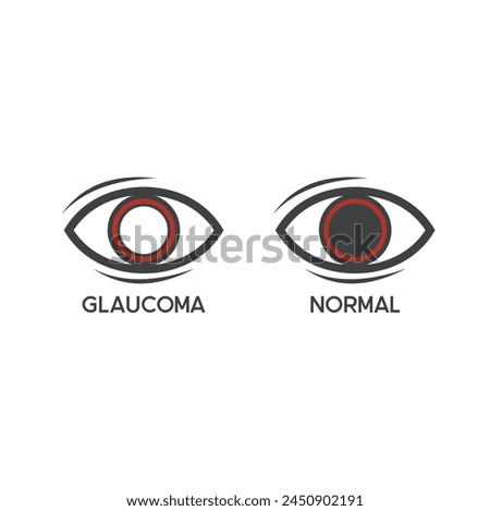illustration of glaucoma, glaucoma eye sufferers.