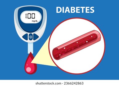 Illustration of a glucose meter device used to check blood sugar levels for diabetes