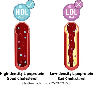 Illustration of good and bad cholesterol types