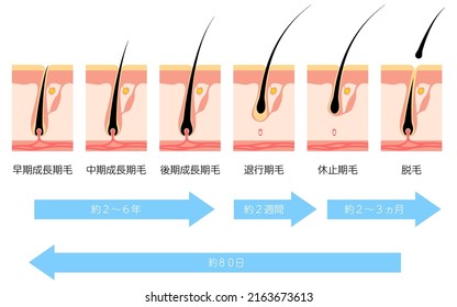 Illustration of the hair cycle and hair growth cycle - Translation: Early growth, middle growth, late growth, regression, resting, hair removal