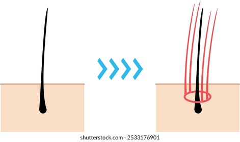 Illustration of hair extensions being applied