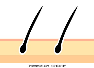 Illustration of hair follicles. Cross-sectional view of a pore.