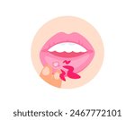 illustration of a hand pulling the lips because of canker sores. mouth ulcers. diseases of the lips or mouth. inner lip hurt. infection and inflammation. health problems. flat illustration design