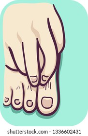 Illustration Of A Hand Scratching An Itchy Feet