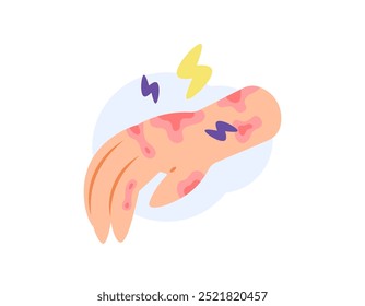 Ilustración de una mano con piel sensible. piel roja, irritada, con picazón y dolor en la mano. alergia. problemas de salud y enfermedades de la piel. diseño de estilo plano. Elementos