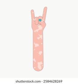 Illustration of a hand with vitiligo making a rock sign. The hand shows vitiligo patterns, emphasizing skin diversity and vitiligo awareness. Vector isolated on white.