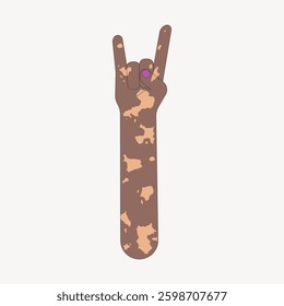 Illustration of a hand with vitiligo making a rock gesture. The hand is brown with lighter patches, symbolizing diversity and acceptance. Rock gesture, vitiligo, diversity. Vector illustration.