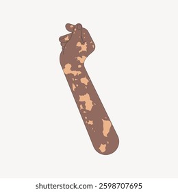 Illustration of a hand with vitiligo, showcasing diverse skin tones. The vitiligo pattern highlights unique beauty. Embrace diversity with vitiligo art. Vector illustration.