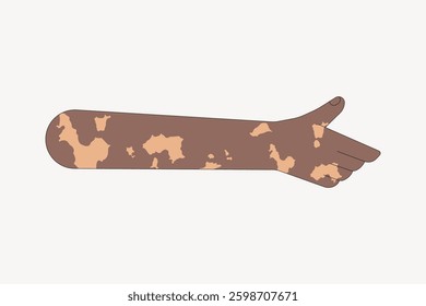 Illustration of a hand with vitiligo, showing skin with varied pigmentation. Vitiligo hand, diverse skin tones, vitiligo illustration, skin diversity. Vector illustration.