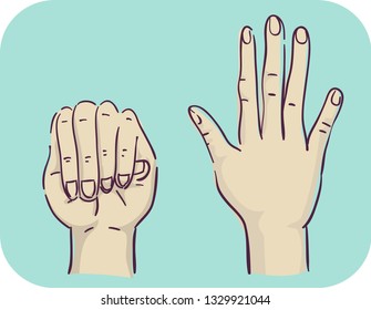 Illustration of Hands with Disproportionately Long Fingers