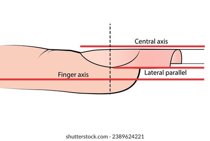 Illustration with hardware manicure technology. Correct nail shape. Educational material on vector