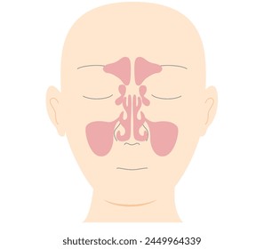 Illustration of head with frontal view of sinuses