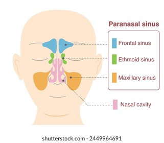 Illustration of head with frontal view of sinuses