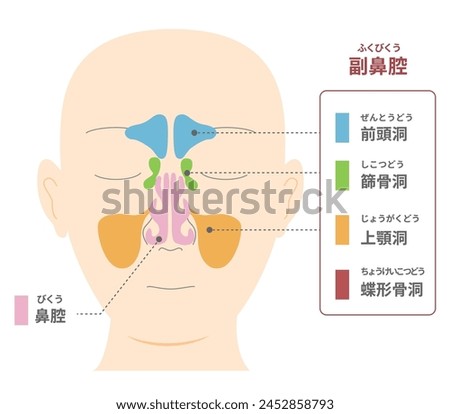 Illustration of head with frontal view of sinuses [TRANSLATE];Paranasal sinus ,Frontal sinus ,Ethmoid sinus ,Sphenoid sinus 