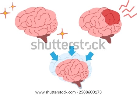 Illustration of a healthy and abnormal brain