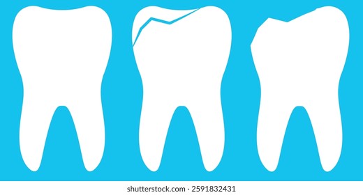 Illustration of Healthy, Chipped, and Fractured Teeth on Blue Background. A detailed depiction showcasing a healthy tooth, a chipped tooth, and a fractured tooth, illustrating dental health concepts, 