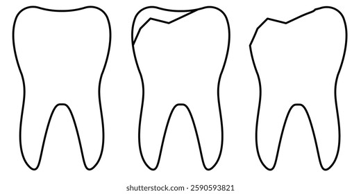 Illustration of Healthy and Damaged Teeth Outlines Showing Dental Concepts. Black and white outline illustration of a healthy tooth contrasted with two damaged teeth, highlighting dental health 