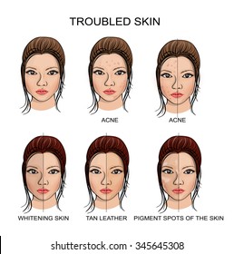 illustration of healthy and problematic skin