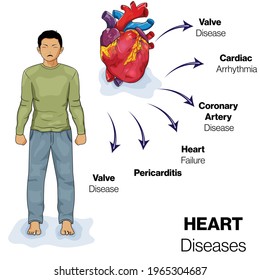 illustration of Heart diseases: collection of heart Disorders, Heart attack, cardiac arrhythmia, valve disease, heart failur.