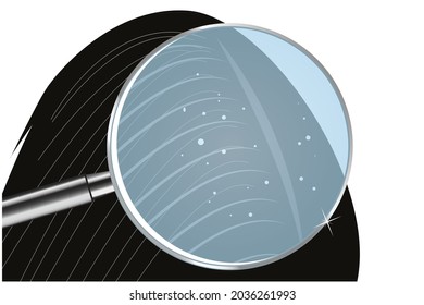Illustration of how dandruff sticks if you don't clean your hair regularly. Vector flat illustration