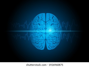 Illustration of human brain with focal seizure showing abnormal sharp wave on electroencephalography or EEG.
