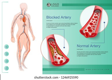 Illustration Of The Human Circulatory Vascular System Template. Anatomical Heart. Man Body Parts. Hand Drown Vector Sketch Illustration Isolated