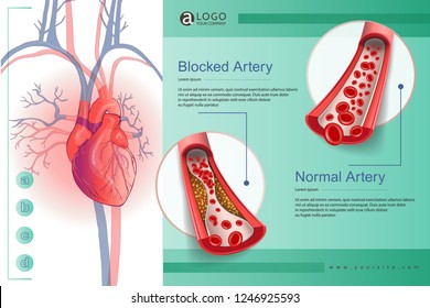 Illustration Of The Human Circulatory Vascular System Template. Anatomical Heart. Man Body Parts. Hand Drown Vector Sketch Illustration Isolated