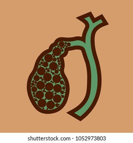 Illustration of Human gallbladder and gallstones anatomy