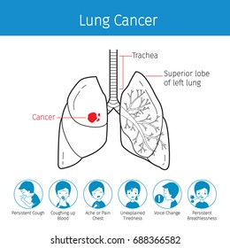Illustration Of Human Lungs, Outline And Lung Cancer Symptoms Icons, Physiology, Sickness, Medical Profession, Morphology, Body, Organs, Health