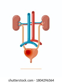 Ilustración del sistema urinario humano con enfermedad, como la cistitis, contiene riñones, uréter, vejiga urinaria, uretra y vasos, ilustración vectorial de diseño plano