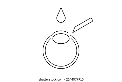 Illustration of ICL (intraocular contact lens) surgery and incision