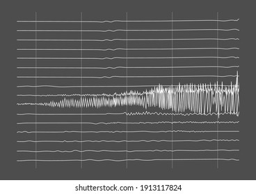 Illustration of ictal EEG recording during seizure. Seizure waves showing high amplitudes and frequency.