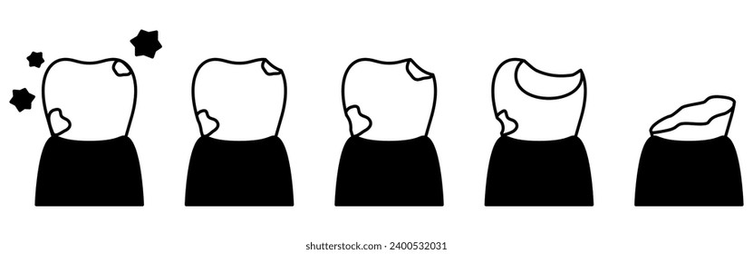 Ilustración de la imagen de la progresión de la cavidad, dibujo de línea simple, Ilustración vectorial