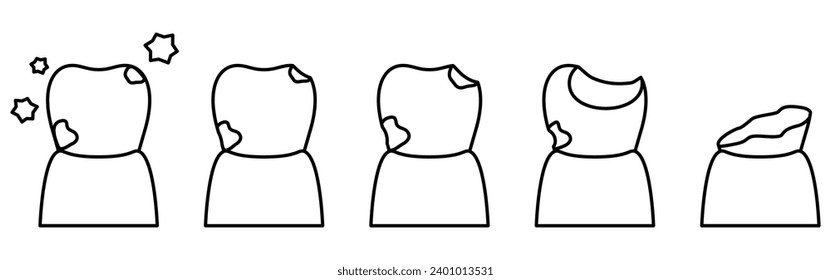 Ilustración de la imagen de la progresión de la cavidad, dibujo de línea simple, Ilustración vectorial