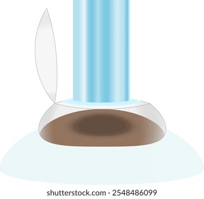 Illustration of an image of laser irradiation in vision correction surgery