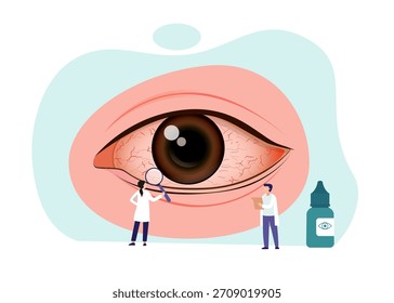 Illustration einer Entzündung des Innenfutters des Augenlids oder der Konjunktivitis. Stockgrafik