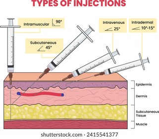 illustration of injection types infographic 