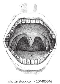 Illustration of the inside of a human mouth, vintage engraved illustration. Usual Medicine Dictionary by Dr Labarthe - 1885.