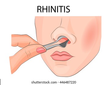 illustration of inspection of the nasal cavity
