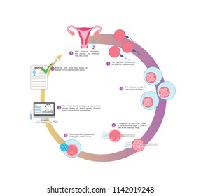 Illustration of an IVF cycle in combination with preimplantation genetic testing