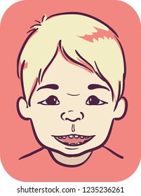 Illustration of a Kid Boy with Angelman Syndrome