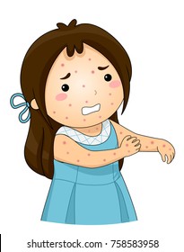 Illustration Of A Kid Girl With Chickenpox Scratching Her Itchy Skin