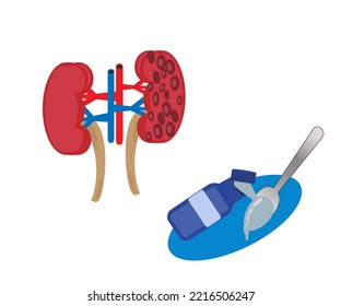 Illustration Of Kidney Disease, Kidney Failure That Occurs In Men, Women, Children, Administration Of Liquid Syrup Drugs For Health