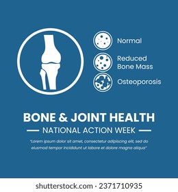 Illustration of Knee Anatomy and Bone Osteoporosis good for Bone and Joint Health National Action Week