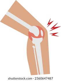 Illustration of knee and joint pain professionally on a white background