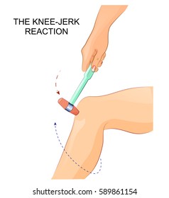 Illustration Knee Reflex Neurology Stock Vector (Royalty Free) 589861154