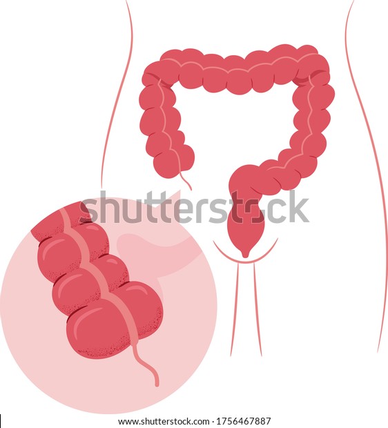 Illustration Large Intestine Body Organ Magnified Stock Vector (Royalty ...