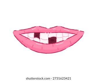 Ilustración de labios con dientes faltantes. Falta de dientes debido a dientes rotos. Labios rosados. Haciendo muecas y sonriendo. Problemas con la boca o los dientes. Estilo de crayón de contorno plano. Fondo blanco.