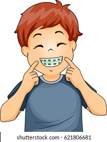 Illustration of a Little Boy Flashing a Wide Smile and Proudly Showing His Dental Braces