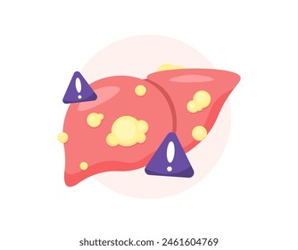 illustration of a liver organ full of fat. Fatty liver disease or hepatic steatosis. Increased fat deposition in the liver. warning of problematic organs. illustration concept design. graphic elements